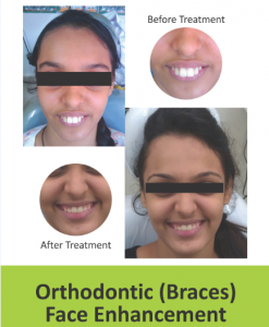 Untitled111 Dr. Prakash Patil&#8217;s Face &#038; Dental Hospital | Dr. Prakash Patil's Face & Dental Hospital